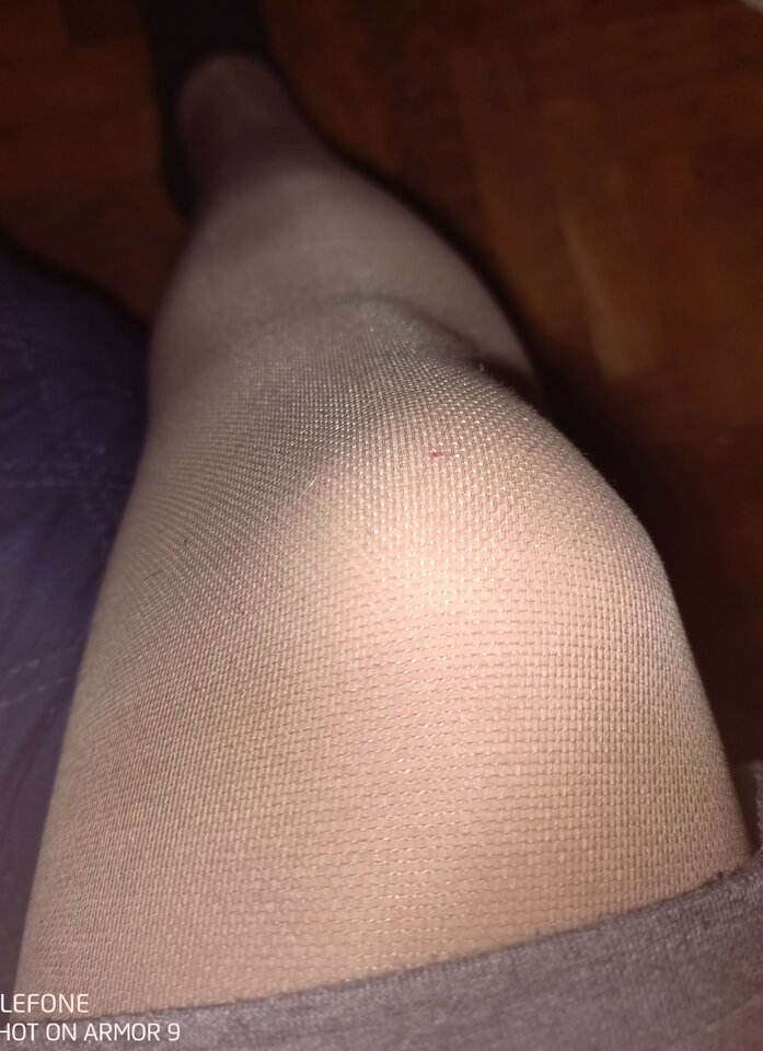 Przeciw żylakowe( ccl2) - bepanthen