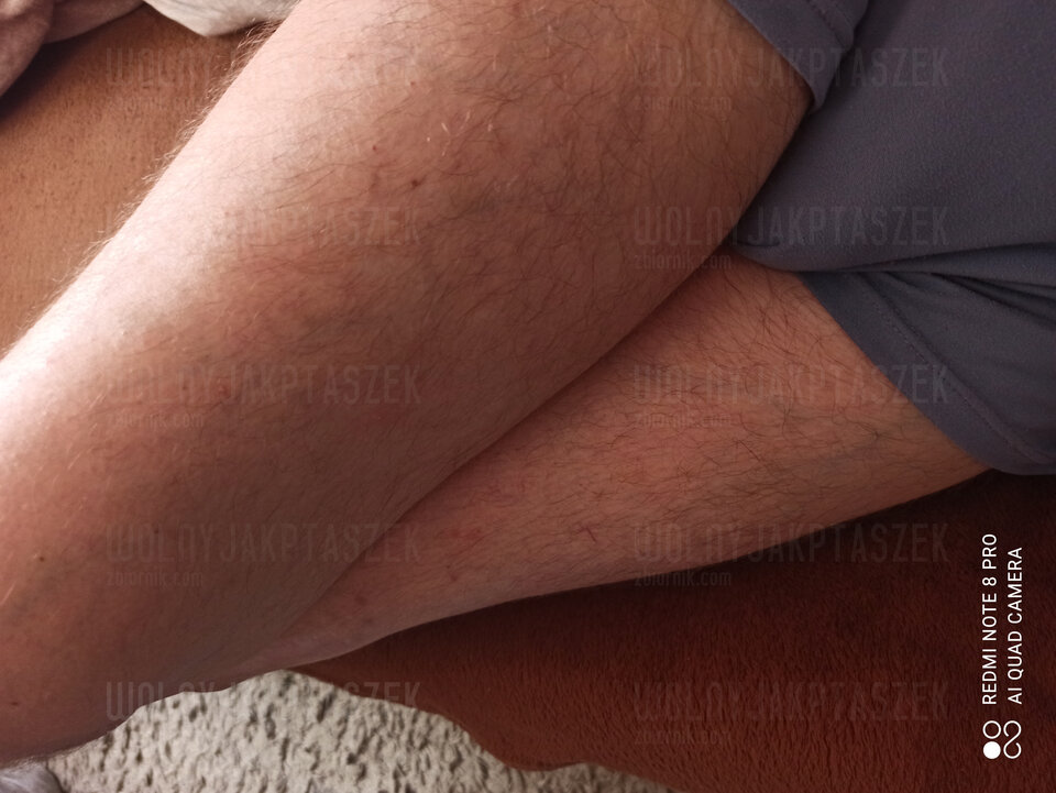 16270323224616569976033000735911.jpg - wolnyjakPtaszek