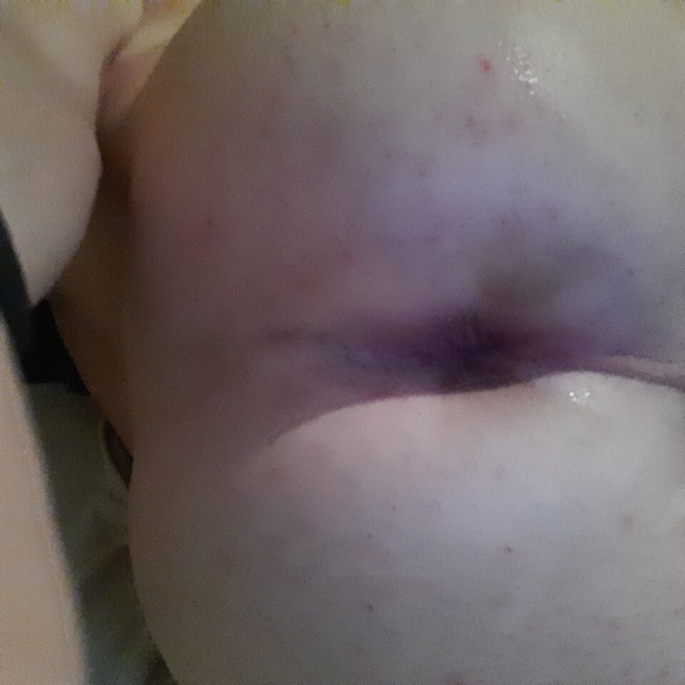 16272464974467387342930167536441.jpg - Palciusia