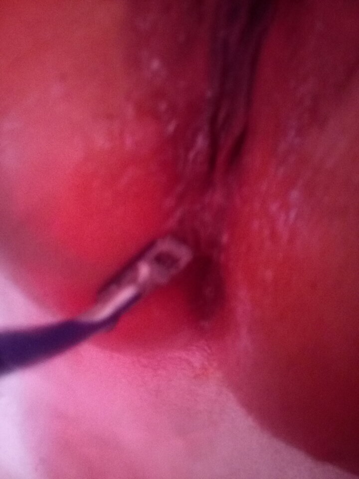 IMG_20210725_165816.jpg - parkapiss1