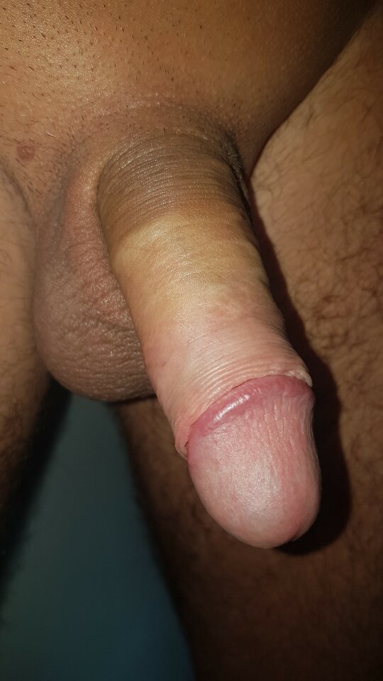 20210802_084339.jpg - madmax01