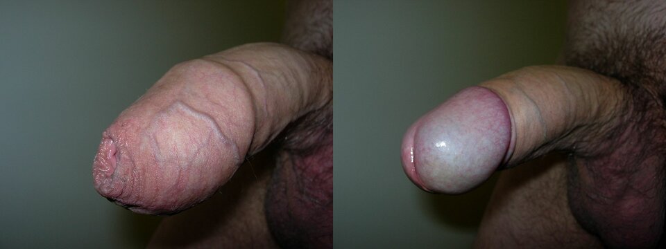 strip tease ? - pawolla