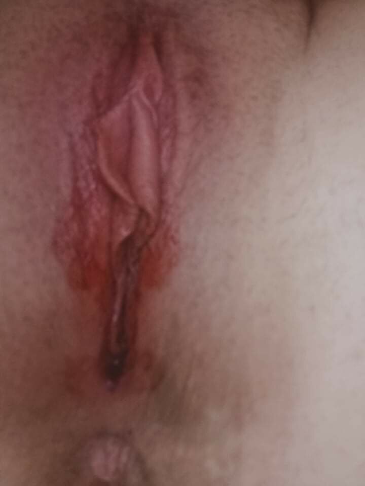 received_397568385048471.jpeg - Dupka85