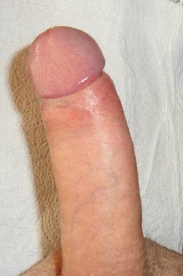 570_1000.jpg - nostive