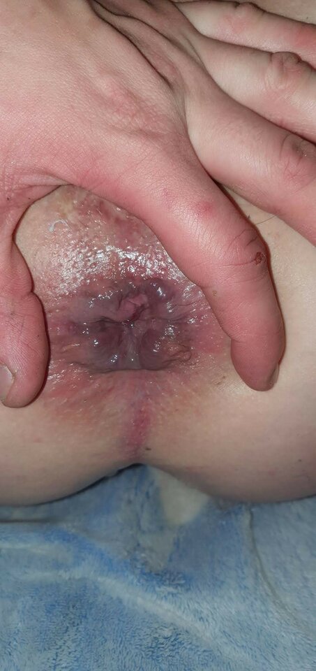 125518881_409591453390899_3106196147580044065_n_409591300057581. - Robaczki888