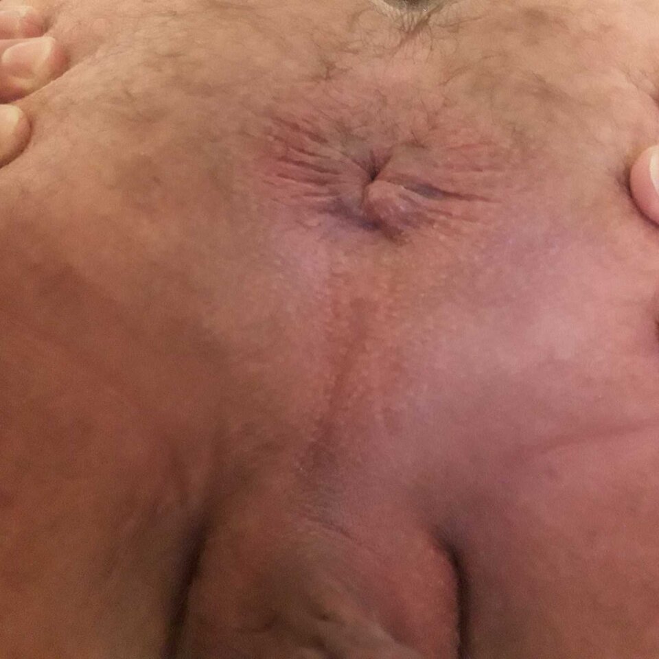 VGSVH3i2Ca.jpg - adasko_euro