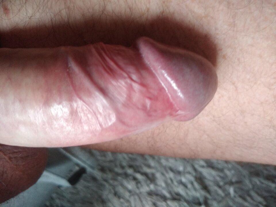 16350604754763056864494887345376.jpg - twoeyes