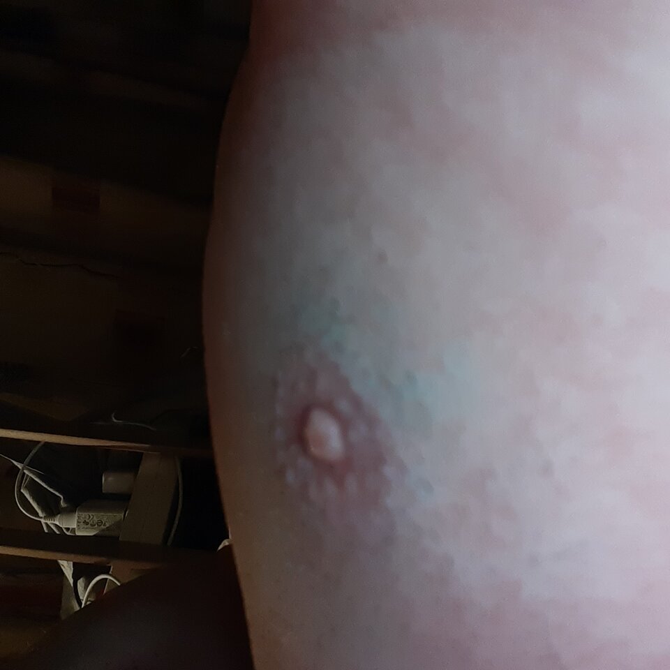 16357138640748950795220423999783.jpg - Palciusia