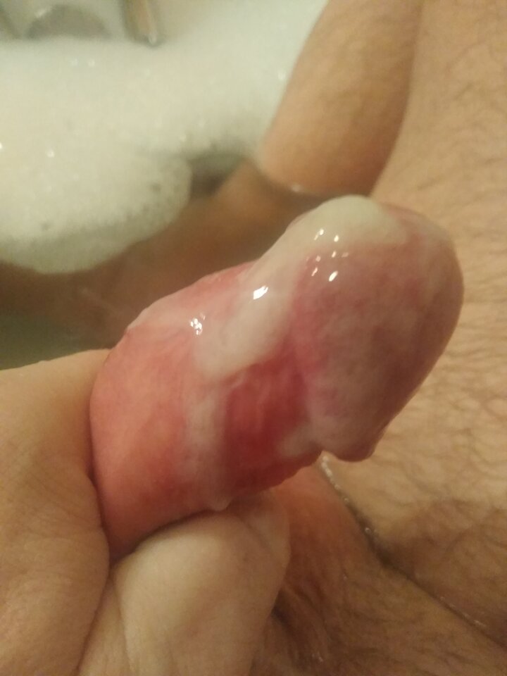 IMG_20211128_202435233.jpg - twoeyes