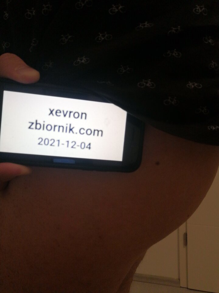IMG_20211204_210800.jpg - xevron