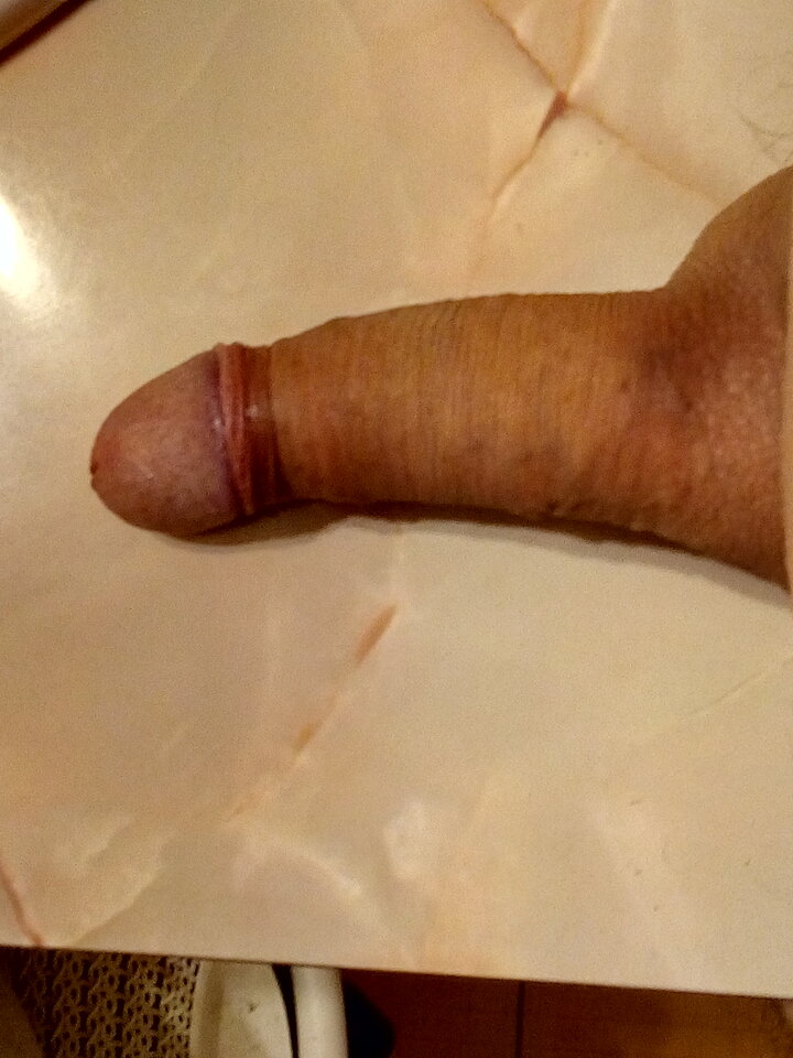 IMG_20211219_122634_HDR.jpg - malzonko