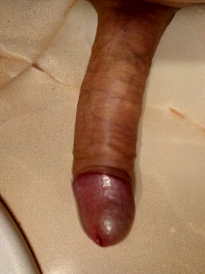 IMG_20211219_123009_HDR.jpg - malzonko