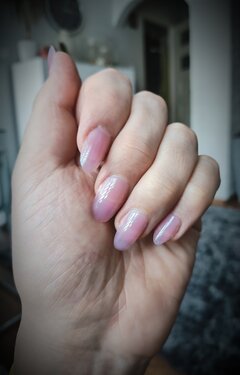 Prosicie o zdjęcia pazurków - ok prosze...