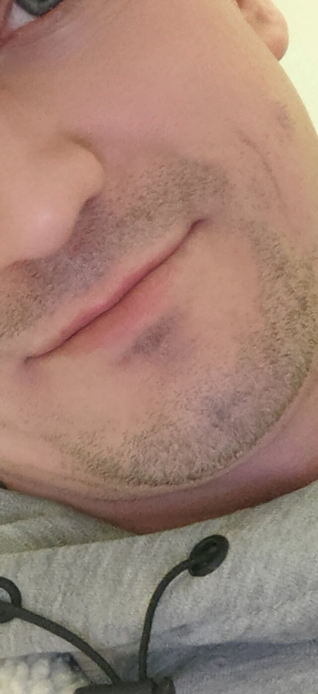 erolife34
