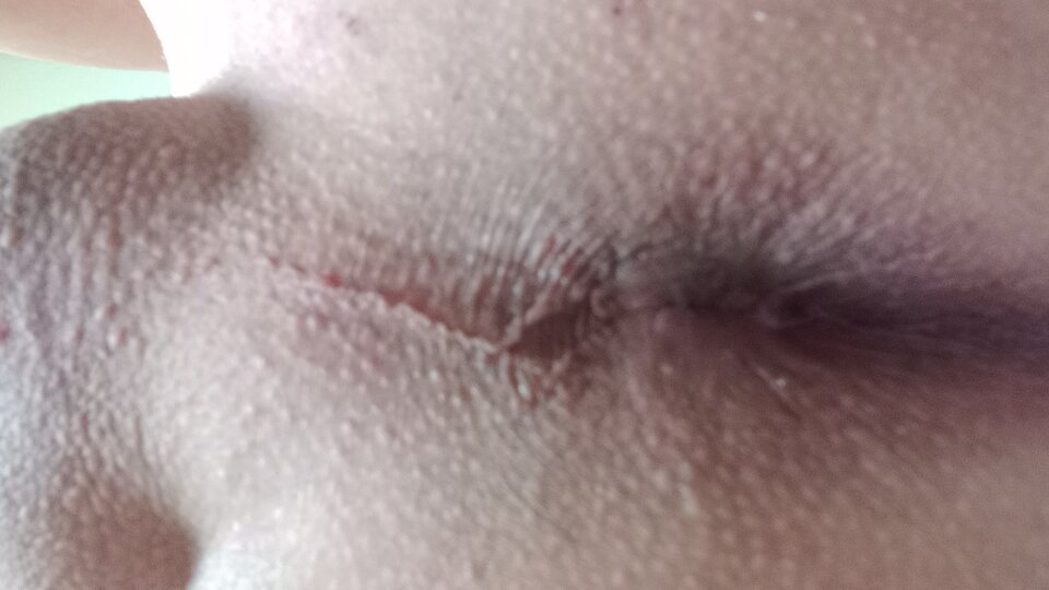 20240301_082218.jpg - Anallove1979