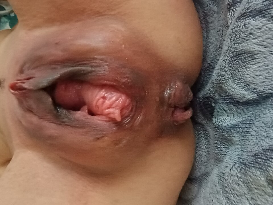 IMG_20241208_145411727.jpg - bananmalpinski