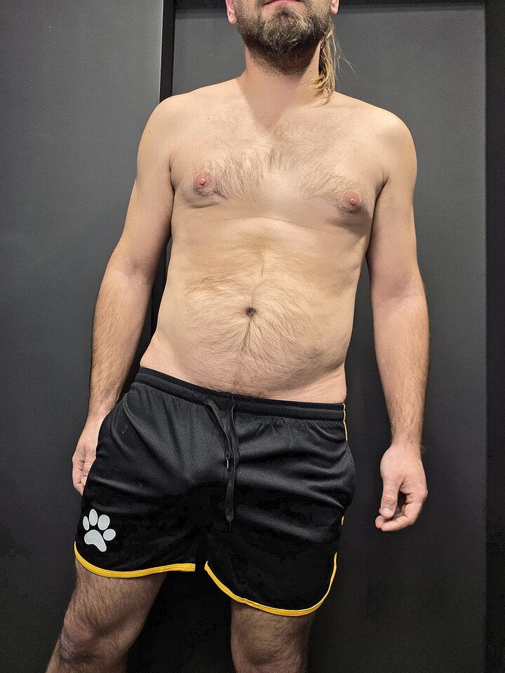 1000020469.jpg - toxict