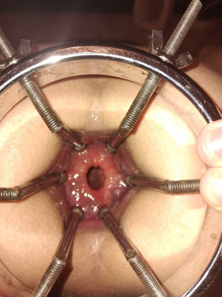 1000015862.jpg - onaioncross