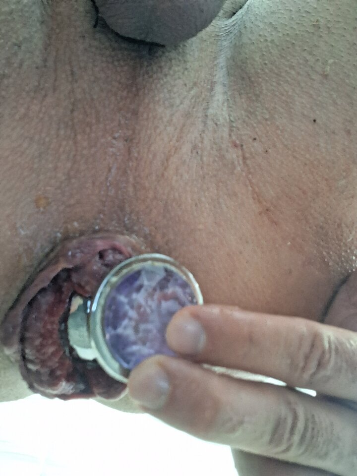 1000010749.jpg - Magic_Holes