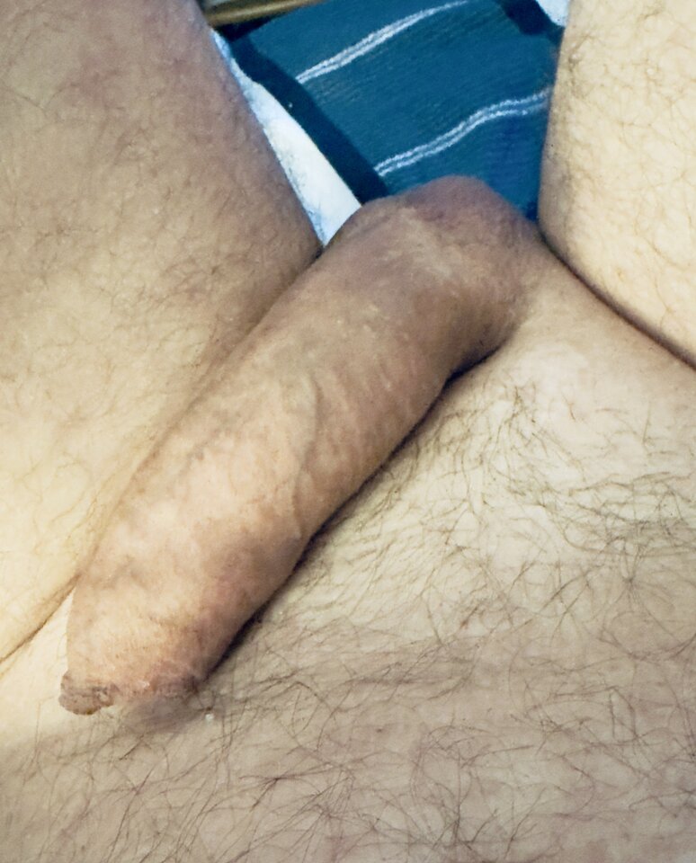 IMG_5801.jpeg - kostka18