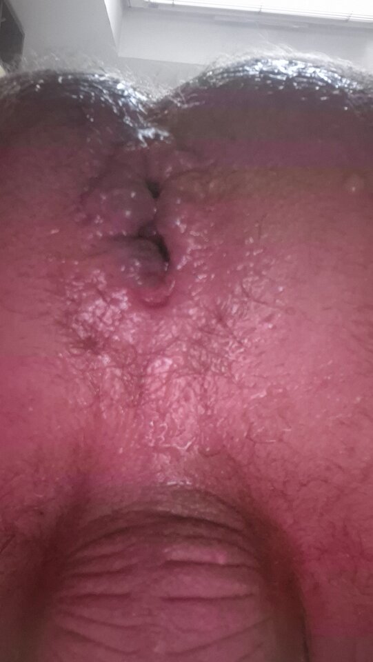 1000010898.jpg - Naturysta70