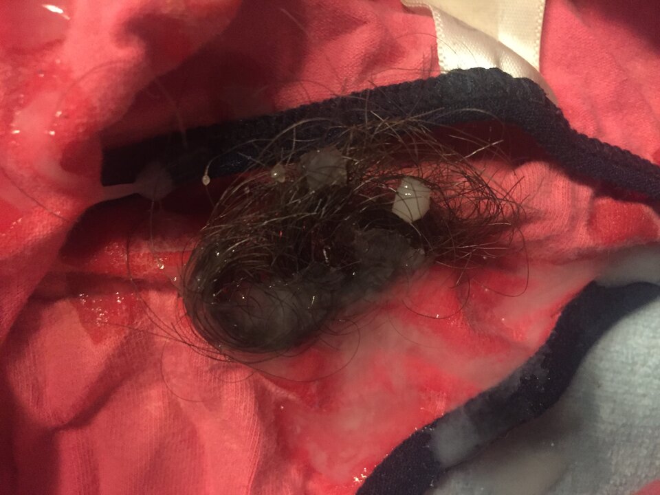 20180322_194348992_iOS.jpeg - Mateo1978