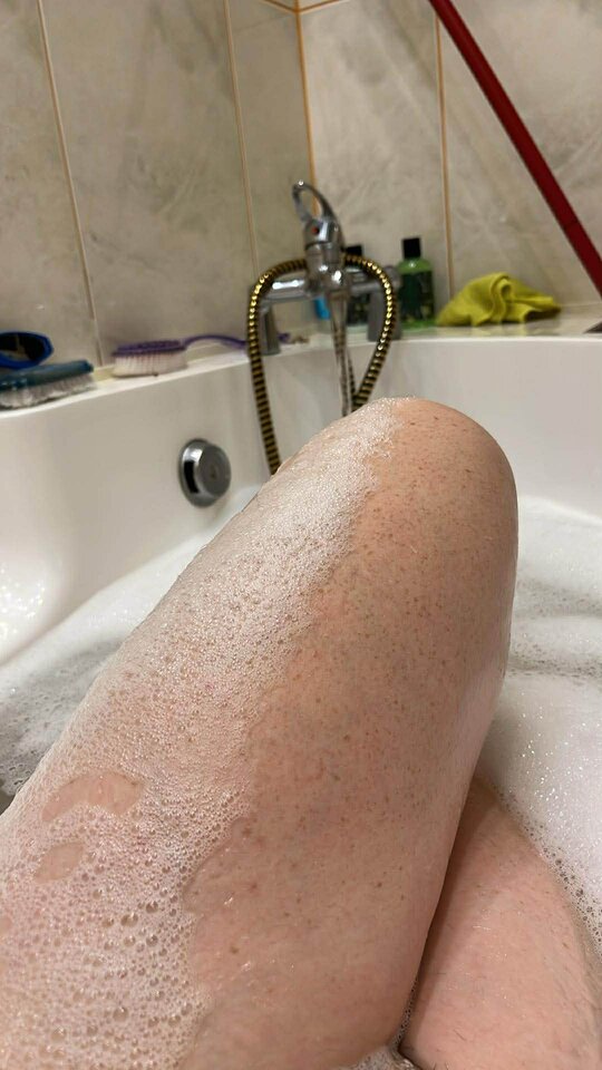 3560.jpg - ParkaTrojmiastoBi