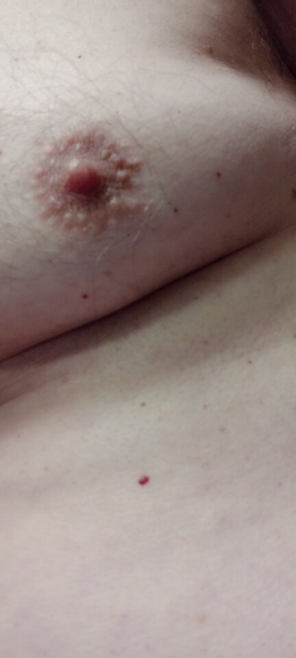 1000017347 - haaggridd